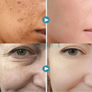 Creme Renovador FaceSlift